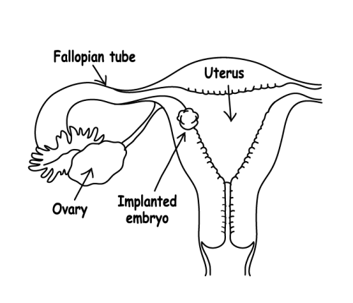 Embryo implantation