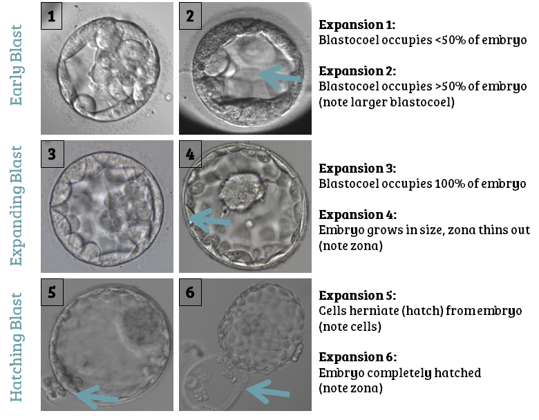 Day 5 embryo grading: expansion grades