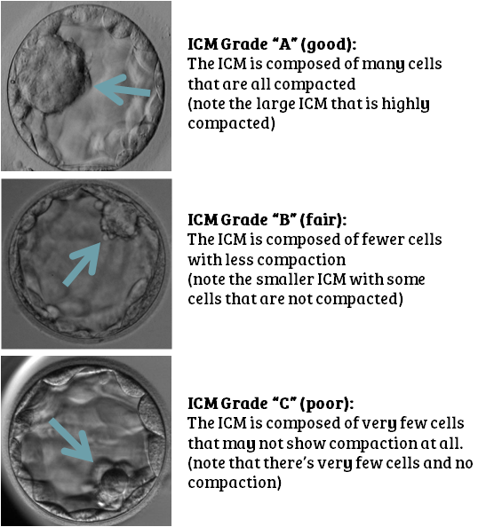 Day 5 embryo grading: inner cell mass grade