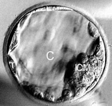 Day 5 blastocyst in real life