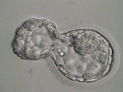 Day 5 blastocyst – hatching