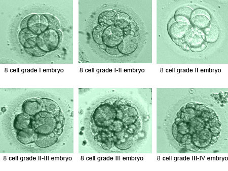 Deciphering your Day 3 embryo grade