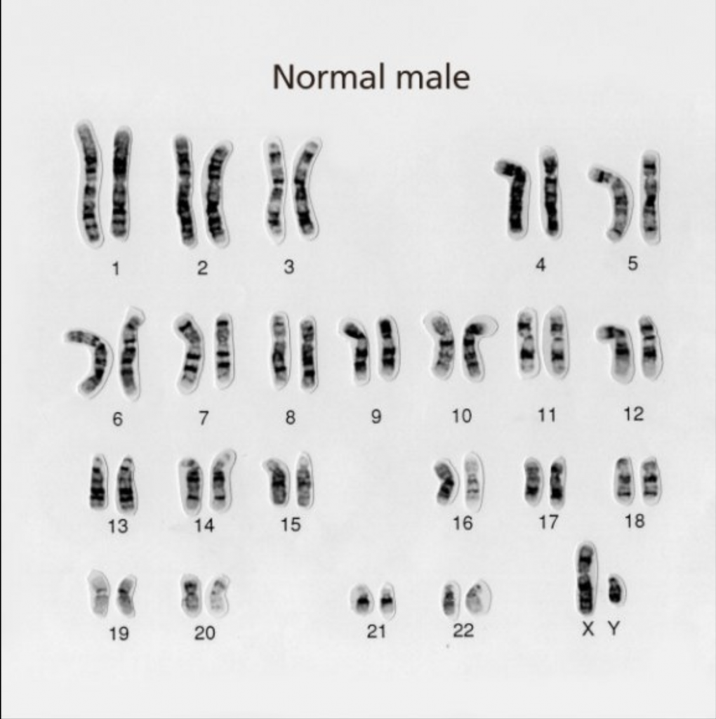 Karyotype of normal chromosome