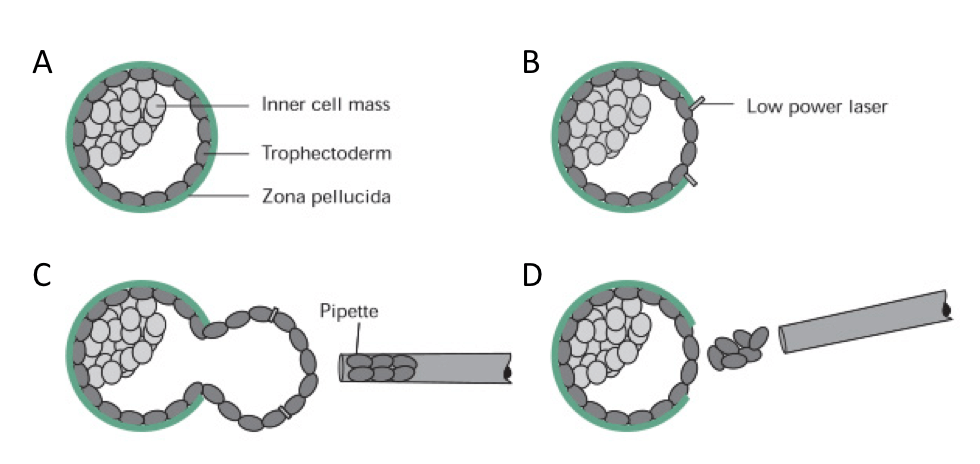 PGS: several cells are removed from the trophectoderm